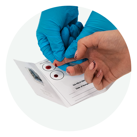 Doctor helping a patient collect a blood sample using a finger prick test card